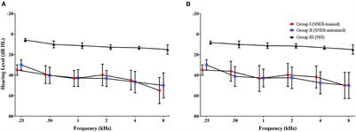 Spatial rehabilitation using virtual auditory space training paradigm in individuals with sensorineural hearing impairment
